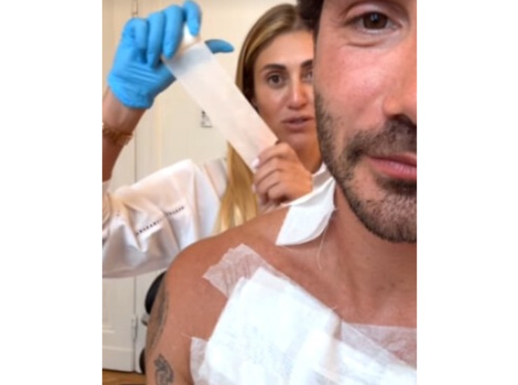 De Martino rimuove i tatuaggi