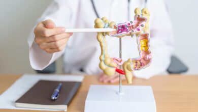 cancro al colon sintomi