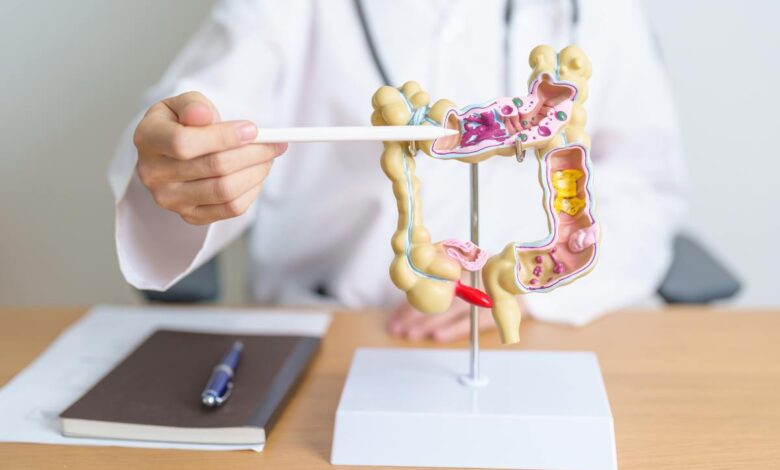 cancro al colon sintomi