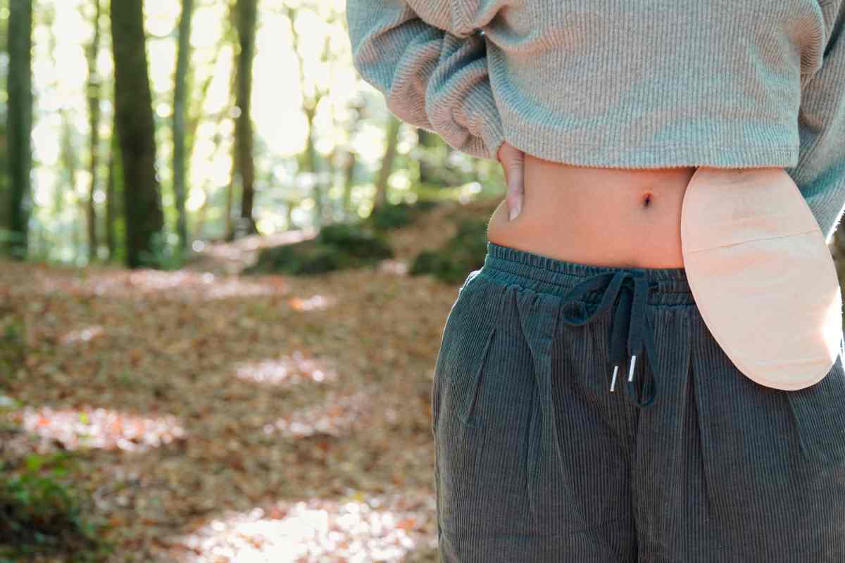 tumore al colon sintomi trattamento 